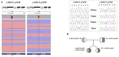 Novel Compound Heterozygous Mutations in IL-7 Receptor α Gene in a 15-Month-Old Girl Presenting With Thrombocytopenia, Normal T Cell Count and Maternal Engraftment